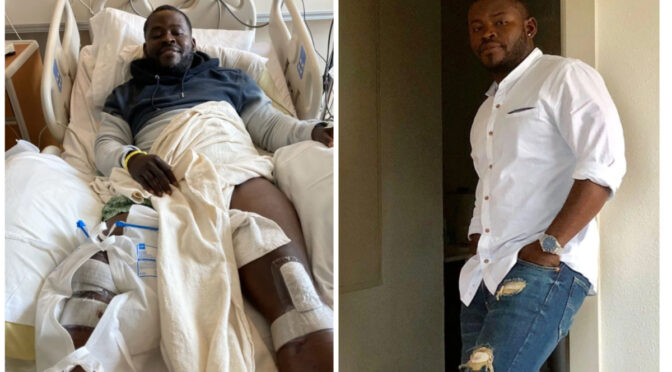 Jionee huyu Mwanaume aliyetumia zaidi ya Mil.300 Kwenye Upasuaji wa kurefusha miguu kufikia inchi tano ili kupata mpenzi.